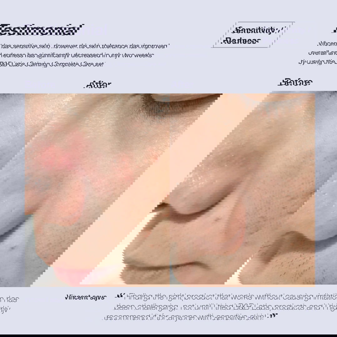 Super-Calm Treatment Essence