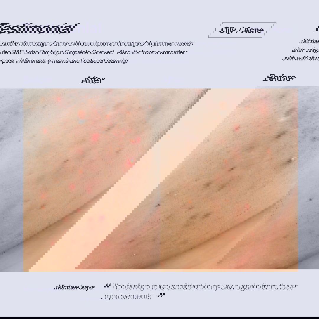 Super-Clear Treatment Essence