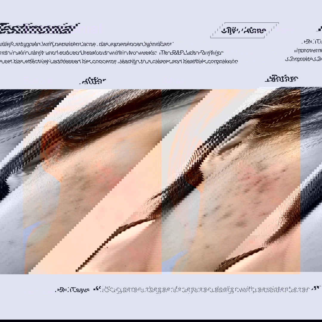 Super-Clear Treatment Essence